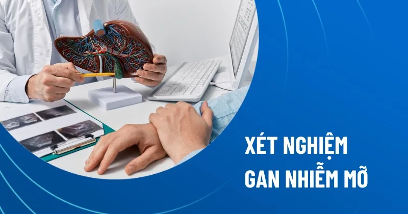 Đánh giá gan nhiễm mỡ cần kết hợp hình ảnh học, xét nghiệm máu và phân tầng nguy cơ xơ hóa.